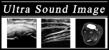 超音波画像診断装置エコー（膝関節）
